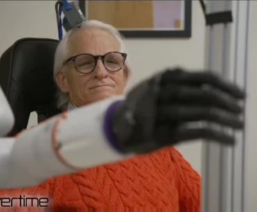 Brain implants and advancements in prosthetics