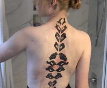 Finally finished filling in. Bleeding like hell, but I love it.