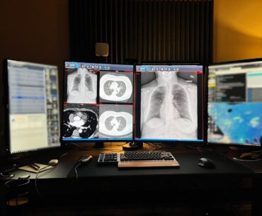 My WFH battlestation -- center two monitors are 28" LG DualUps. Left is a 24" 1080p and the right is a 27" 1200p.