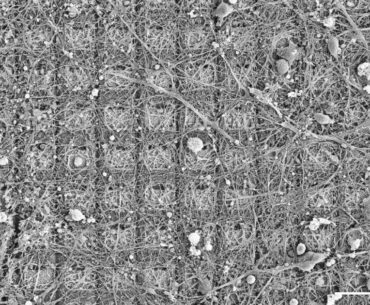 Australian military is funding a computer chip merged with human brain cells