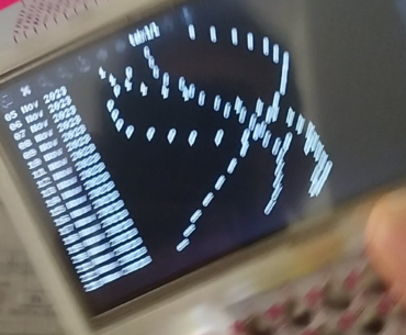 BIOrhyTHm CyberSINE