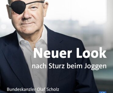 New look: German Chanchellor Scholz had an accident