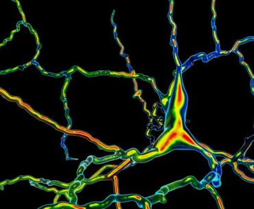 A Biotech Company Says It Put Dopamine-Making Cells Into People's Brains