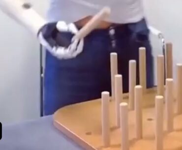 Why is every person with Prosthetic Hands the hottest person to ever live?