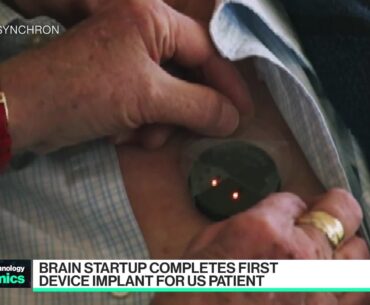 Sychron Brain Implants
