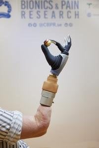 Groundbreaking achievement as bionic hand merges with user’s nervous and skeletal systems.