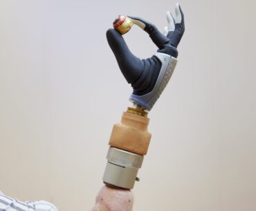 Bionic hand merges with user's nervous and skeletal systems, remaining functional after years of daily use