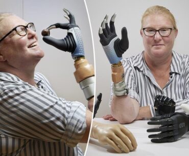 ‘Bionic woman’ is first to have robotic limb merged with bone — and controlled with her mind By Social Links forBrooke Steinberg