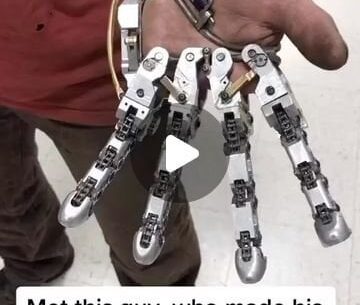 Man creates bionic hand after losing fingers