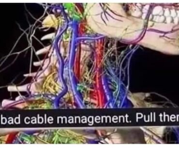 Guys suggest a way for better cable management