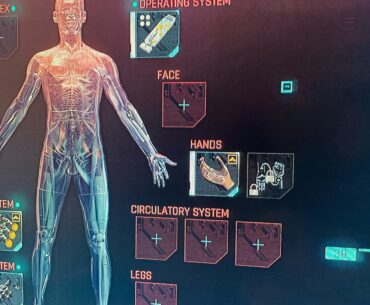Is there a reason I don’t have an eye implant?