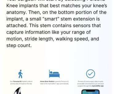 This smart knee replacement implant that connects to your phone is cyberpunk AF