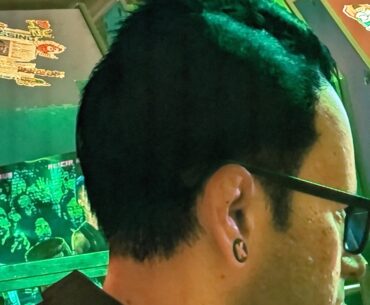 Noticed Vik has Cauliflower ear. Really cool detail showing he really does box/fight