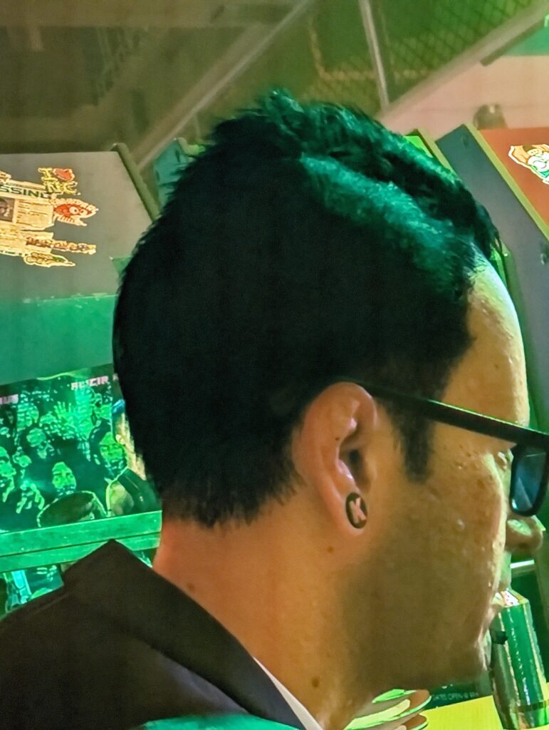 Noticed Vik has Cauliflower ear. Really cool detail showing he really does box/fight
