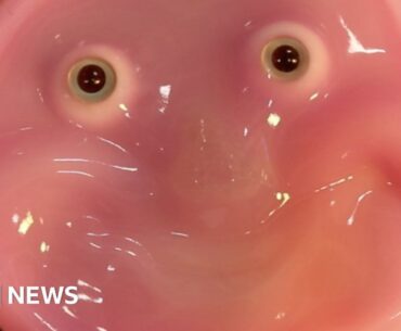 Japanese scientists have found a way to attach living skin to robot faces