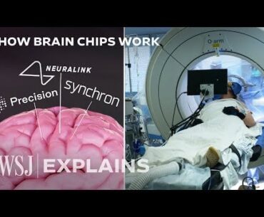 Neuralink's Rival Tests Brain Chip in Race to Bring Implants to Market | WSJ