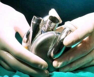 World First Implantation Of Titanium Heart Harnessing Maglev Technology