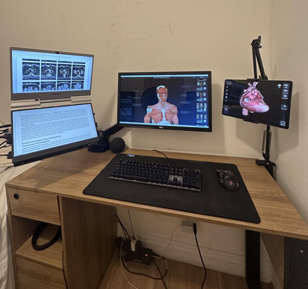 How can I improve my setup?