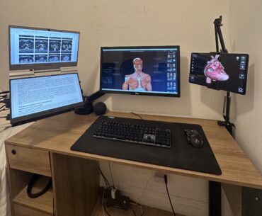 How can I improve my setup?