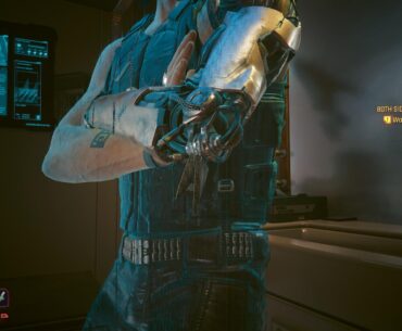 What exactly is the purpose of that little part of the elbow?