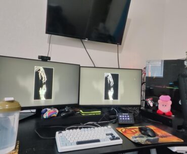 My setup