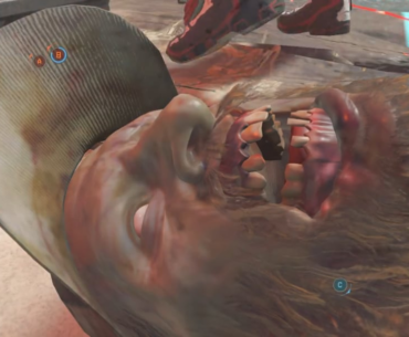 Don't worry, he's pretending to be in pain.