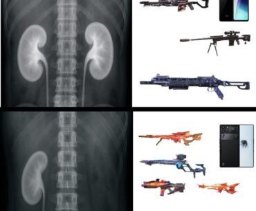 Ctto