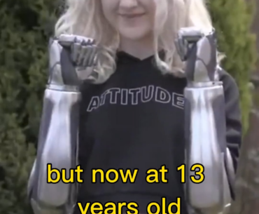 Cyborgs now one step closer to reality as teen girl becomes first human with fully cybernetic arms