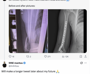 mantuu has broken his arm, he reveals on X