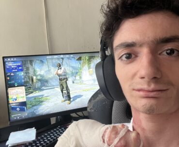 I’m a long-time CS player with a rare disease — this is my story