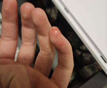 Is it just me, or do PCs sometimes require a blood sacrifice to work?