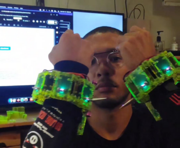 plasma bracelet upgrades in progess