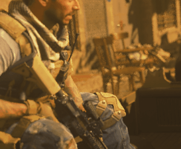 Alex's hair looking bald