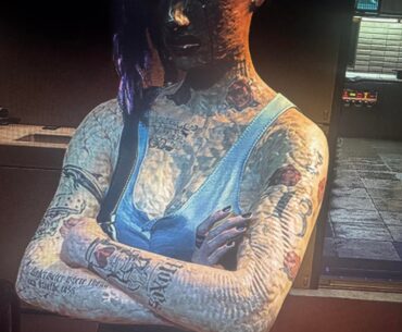 Can anyone help not sure what’s going on with my skin or how to fix it using mods for body but I’m not sure what’s to even look for