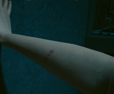 Can any ripperdocs tell me what these dots on my arm are?