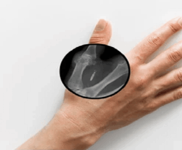 Magician Forgets Password to RFID Chip Implanted in His Hand