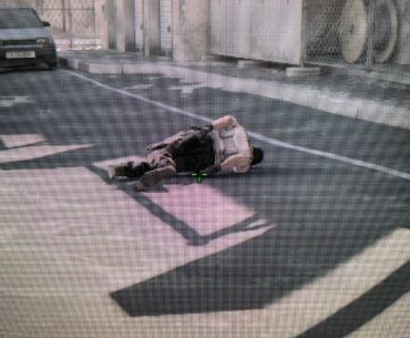 bro must’ve fallen down some stairs lmaooo