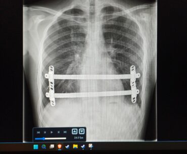 Rate the chrome chooms