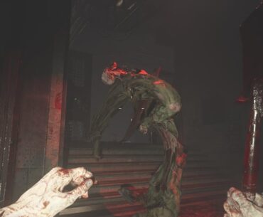 What do we think of the new Scoliosis zombie?