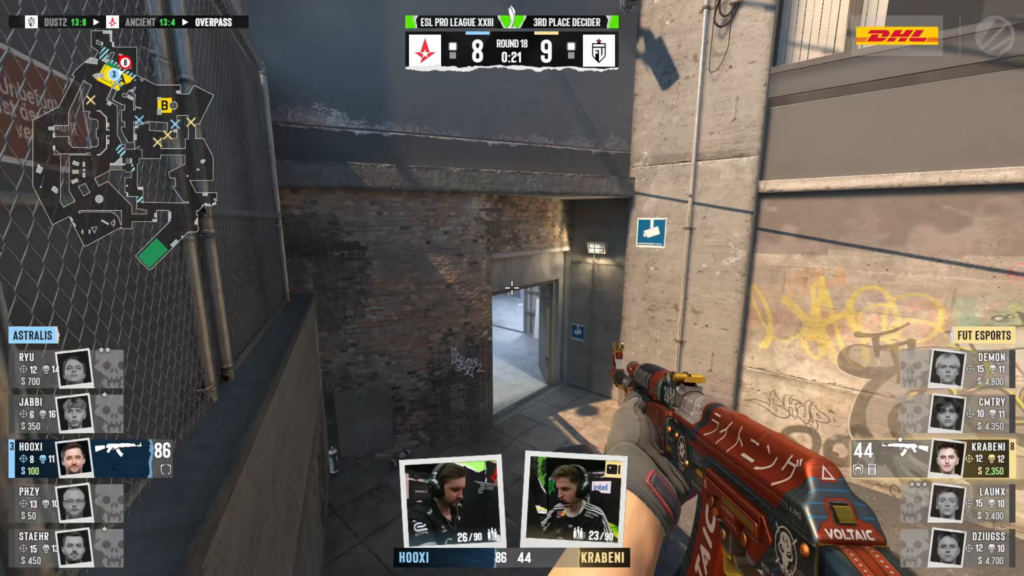 Hooxi almost has a heart attack