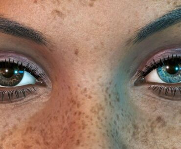 TIL that Alex has Heterochromia (two eye colors)