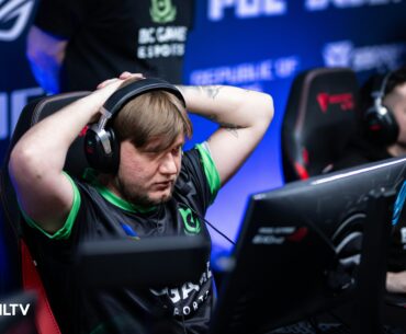 s1mple : "Our team lacks skill. Our players aren't able to win rounds individually like in most others teams."