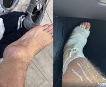 huNter broke his leg ahead of the tournament. HLTV reported that SunPayus will serve as captain. We wish you a speedy recovery huNter <3